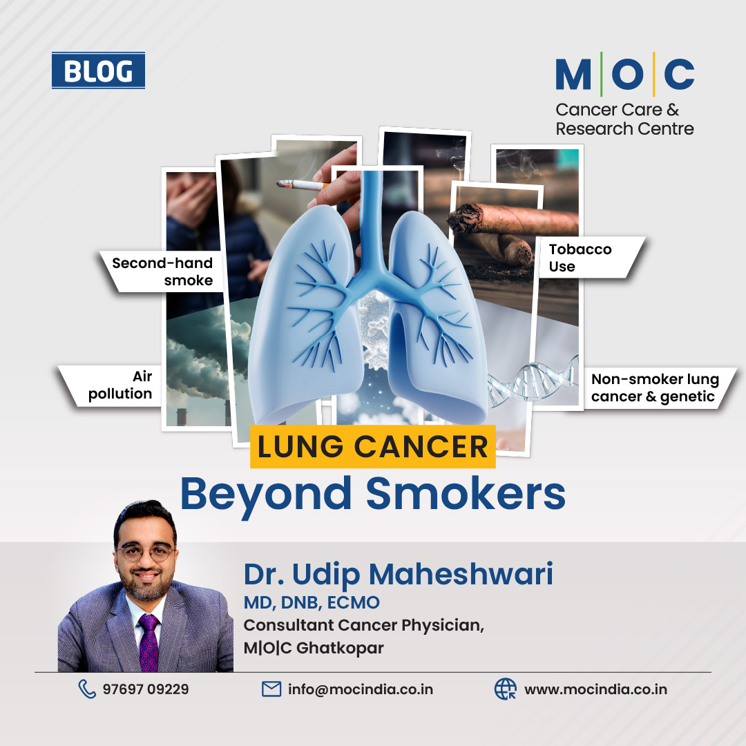Lung Cancer Beyond Smokers | Dr Udip Maheshwari | Cancer Physician | M|O|C Ghatkopar